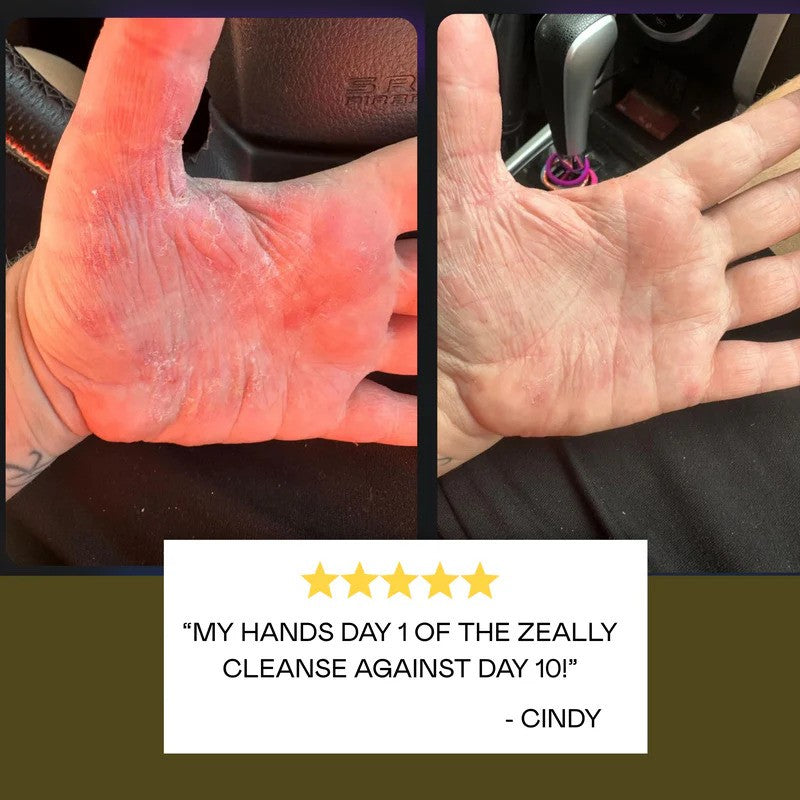 Zeally Herbs 10 Day Parasite & Heavy Metal Cleanse Bundle